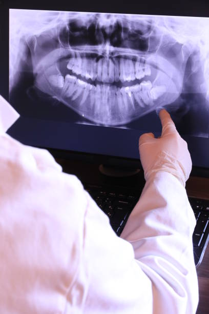 Best Emergency Dental Extractions in Fairwood, MD